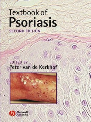 cover image of Textbook of Psoriasis